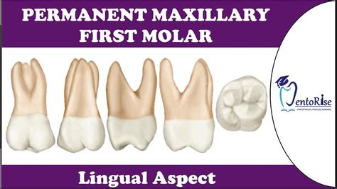 First maxillary molar (part 1) .